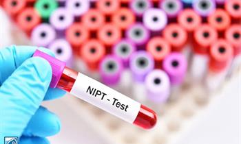 آنچه می بایست در مورد تست NIPT یا سل فری بدانیم!